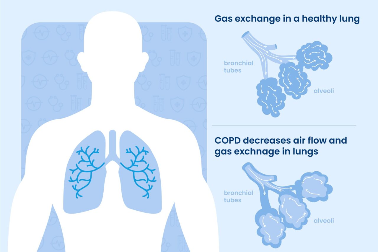 Lungs की बीमारियों से बचना है तो अपने आहार में इस सुपर फूड को जरूर करें शामिल 1 Lungs की बीमारियों से बचना है तो अपने आहार में इस सुपर फूड को जरूर करें शामिल