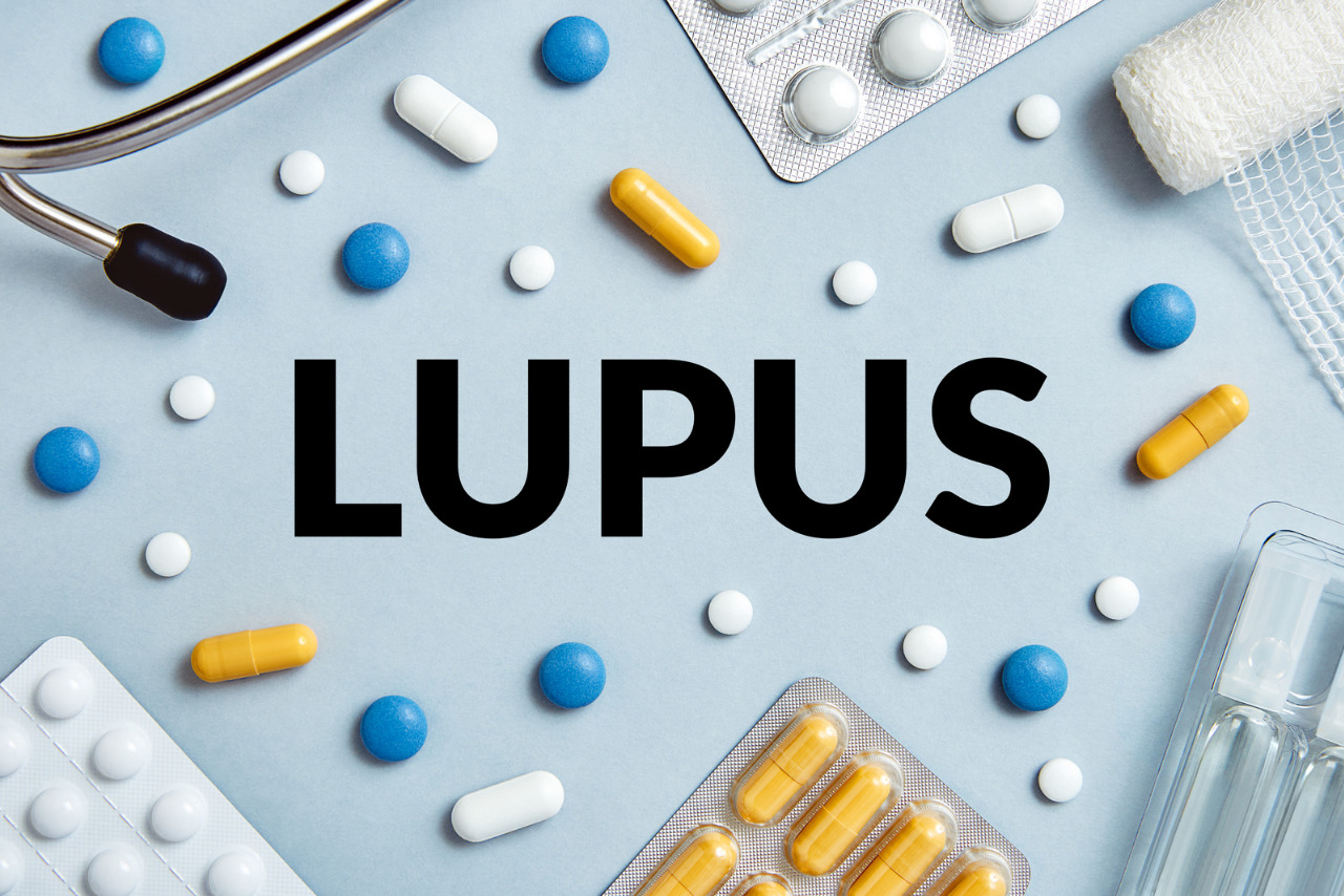 Delhi Aiims News : गर्भधारण के दौरान ल्यूपस (LUPUS) की दवा से बच्चे में हो सकती है विकृति 1 Delhi Aiims News : गर्भधारण के दौरान ल्यूपस की दवा से बच्चे में हो सकती है विकृति