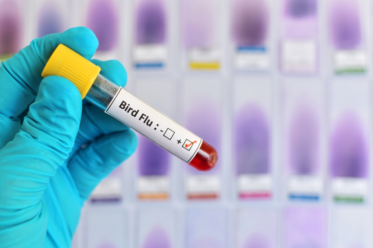 First Bird Flu Death in US : H5N1 से संक्रमित अमेरिका (United State) में पहली इंसानी मौत 1 First Bird Flu Death in US : H5N1 से अमेरिका (United State) में पहली इंसानी मौत